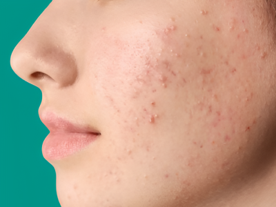 Dr. Mukesh Sharma Best Ayurvedic Wellness Center in Jaipur